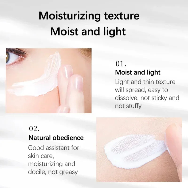 Whitening Freckles Cream Remove Melasma Dark Spots