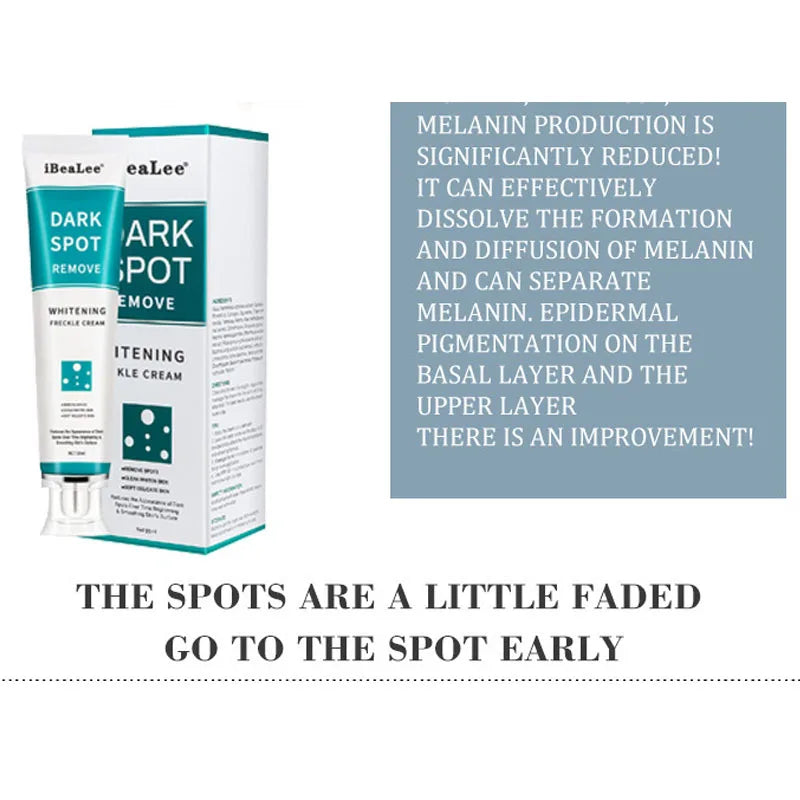 Whitening Freckles Cream Remove Melasma Dark Spots